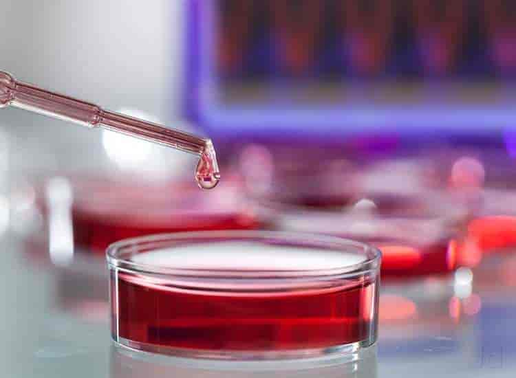 Lab Test by Diagnostic Endocrinolotgy Centre in Thrippunithura ...