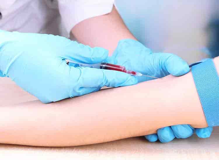 SRL Diagnostics Swamy Smarth Pathology Collection Center Bhandup West Pathology Labs In
