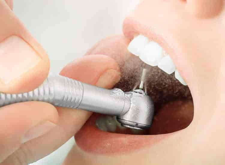Dr. Saranya (National Dental Care) in Kphb Colony,Hyderabad Best