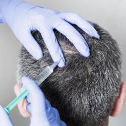 Perfect Hair Transplant in Gomti Nagar - Best Dermatologists in Lucknow - Justdial Perfect Hair Transplant in Gomti Nagar - Best Dermatologists in Lucknow - Justdial
