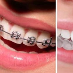 Did You Start cosmetic smile redesign For Passion or Money?