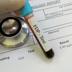 Top Ambulatory Blood Pressure Monitoring Centres in Cooch Behar Best Abpm Centers Justdial