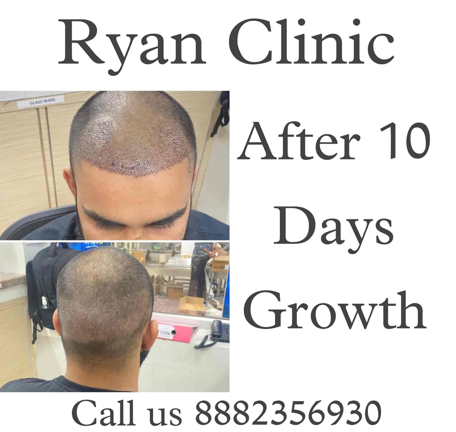 Share more than 149 hair clinic in delhi latest camera.edu.vn