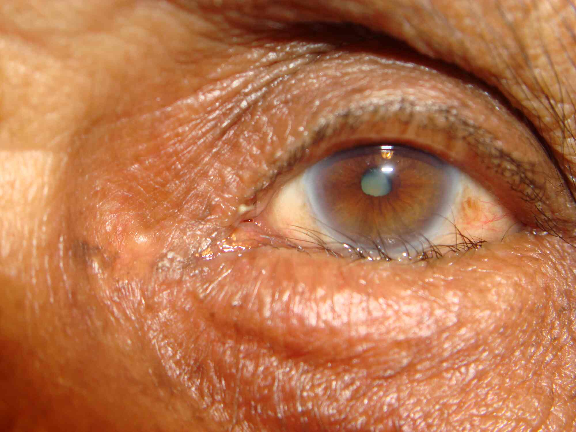 List Of Best Eye Hospitals in Rohini Sector 17 Best Eye Doctor near