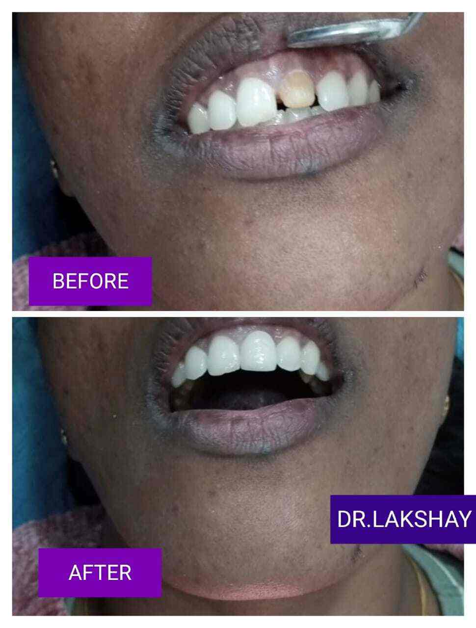 R G Dental in Vikaspuri,Delhi Best Dental Clinics in Delhi Justdial