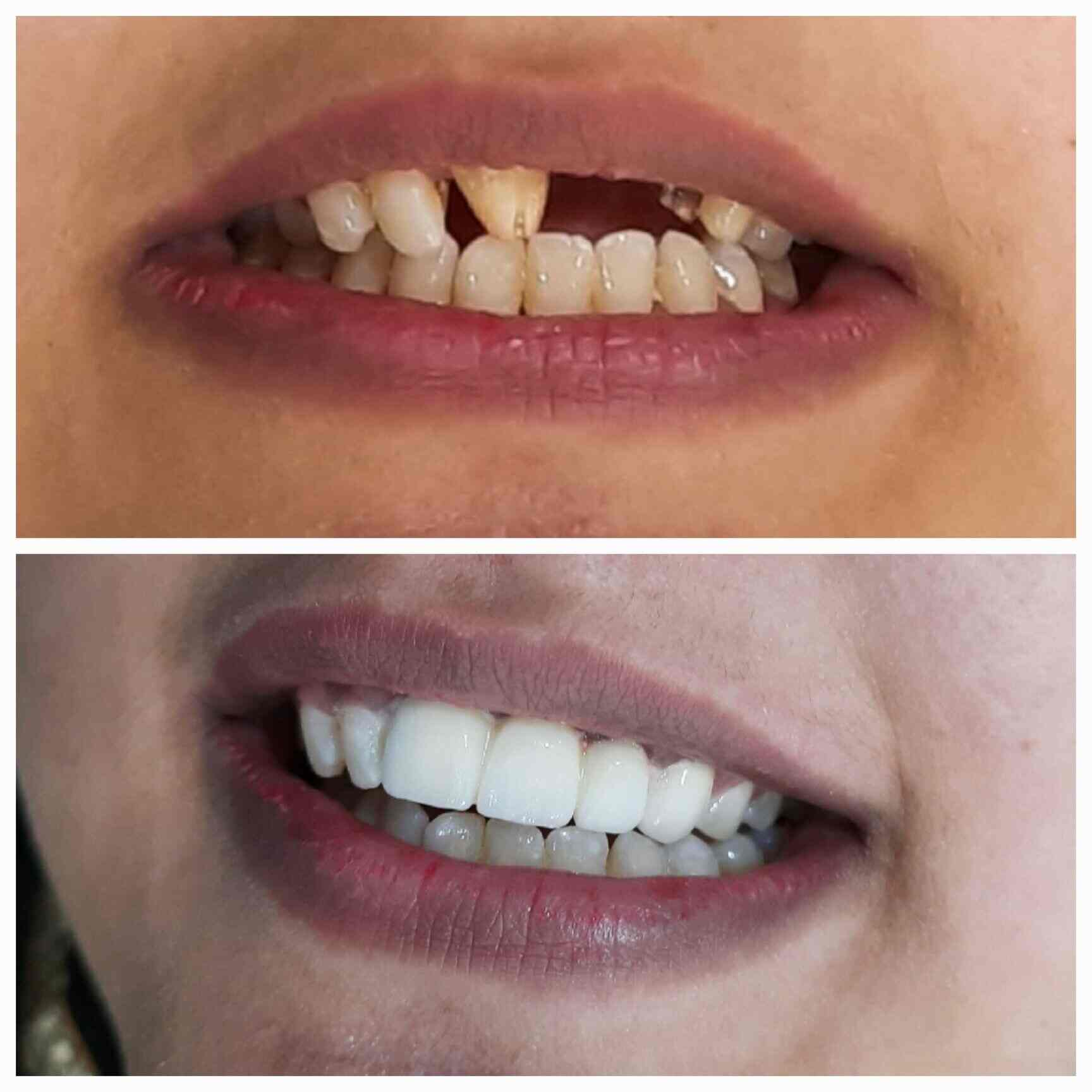 R G Dental in Vikaspuri,Delhi Best Dental Clinics in Delhi Justdial