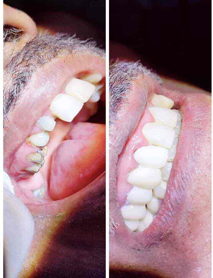 R G Dental in Vikaspuri,Delhi Best Dental Clinics in Delhi Justdial