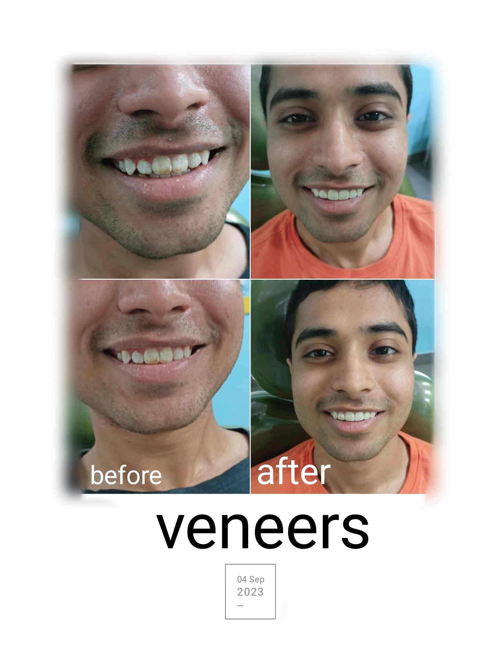 Fortis Dental Vasant Kunj in Vasant Kunj,Delhi Book Appointment