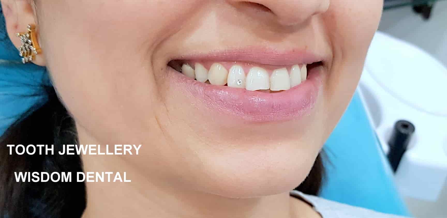 Wisdom Dental in Janakpuri,Delhi Best Dental Surgeons in Delhi Justdial
