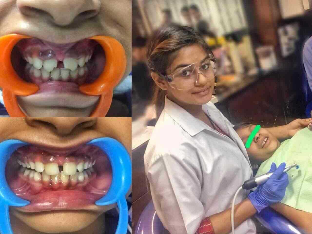 Dental Blush By Dr. Anukriti Bansal Aggarwal Dentists Book