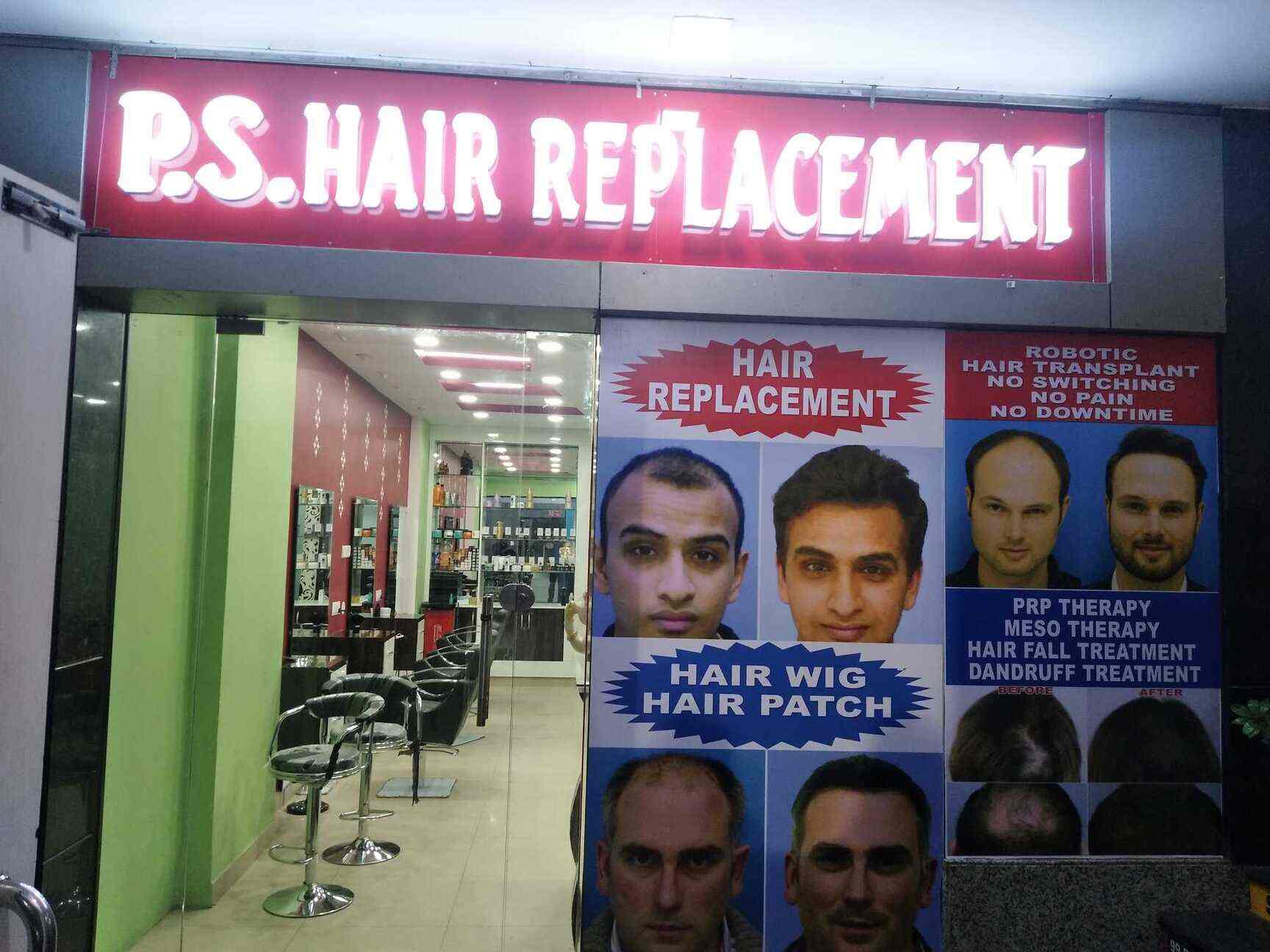 Top Hair Patch Dealers in South Delhi, Delhi near me Justdial