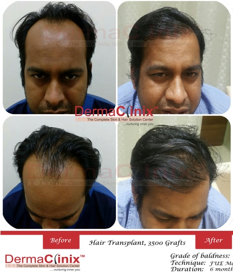 Dr. Kavish Chouhan in Defence Colony - Best Lactic Peel Treatment in Delhi - Justdial Dr. Kavish Chouhan in Defence Colony - Best Lactic Peel Treatment in Delhi - Justdial