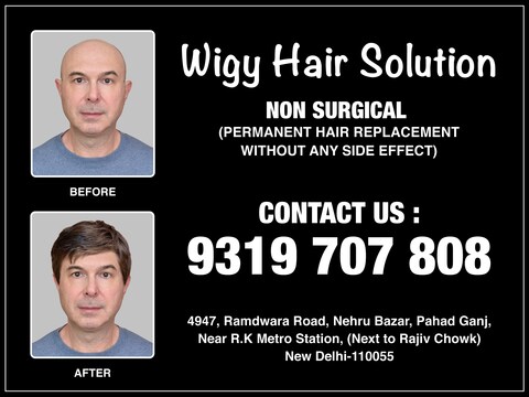 Wigy Hair Solution in Pahar Ganj - Best Wig Dealers in Delhi - Justdial Wigy Hair Solution in Pahar Ganj - Best Wig Dealers in Delhi - Justdial