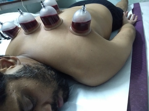 Cupping Therapy In Delhi in Karol Bagh - Book Appointment Online - Best Cupping Therapy Centres in Delhi - Justdial Cupping Therapy In Delhi in Karol Bagh - Book Appointment Online - Best Cupping Therapy Centres in Delhi - Justdial