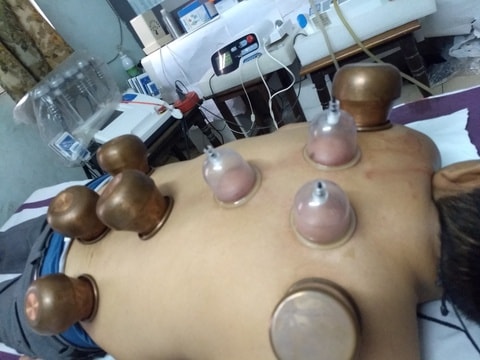 Cupping Therapy In Delhi in Karol Bagh - Book Appointment Online - Best Cupping Therapy Centres in Delhi - Justdial Cupping Therapy In Delhi in Karol Bagh - Book Appointment Online - Best Cupping Therapy Centres in Delhi - Justdial
