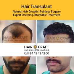 Hair O Craft in Panampilly Nagar,Ernakulam - Best Hair Transplant Clinics in Ernakulam - Justdial Hair O Craft in Panampilly Nagar,Ernakulam - Best Hair Transplant Clinics in Ernakulam - Justdial