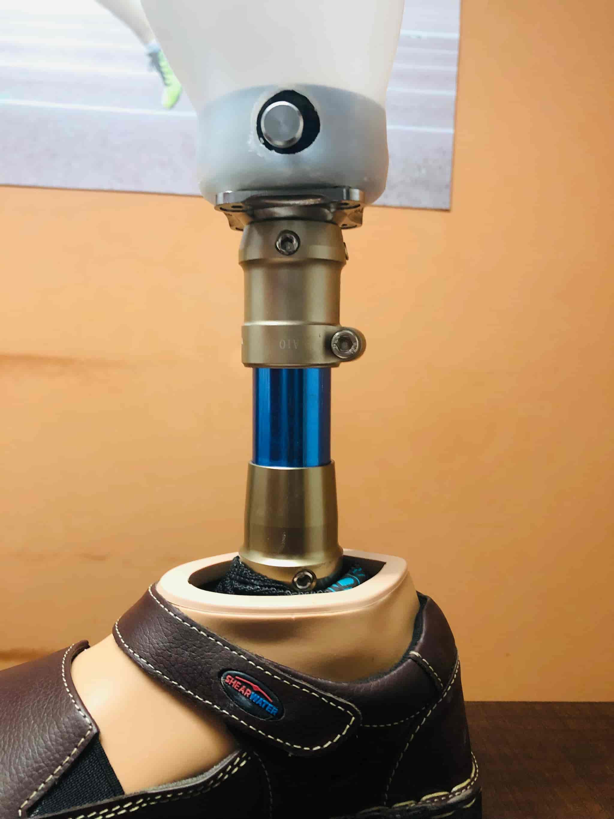 Top Artificial Limb Fitting Centres in Kozhikode Best Artificial Leg