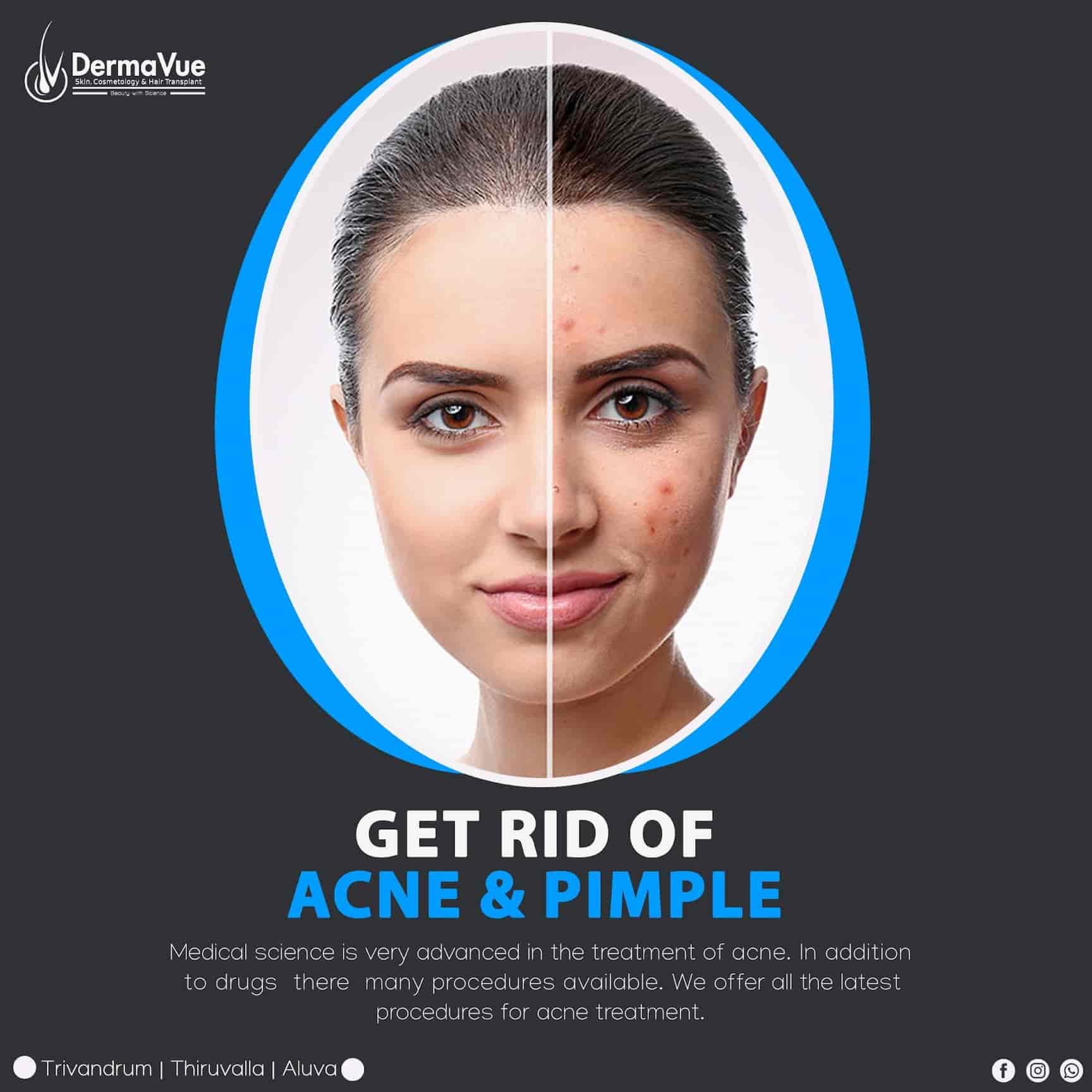 Dermavue in Near Pulinchodu,Ernakulam - Best Skin Care Clinics in Ernakulam - Justdial Dermavue in Near Pulinchodu,Ernakulam - Best Skin Care Clinics in Ernakulam - Justdial