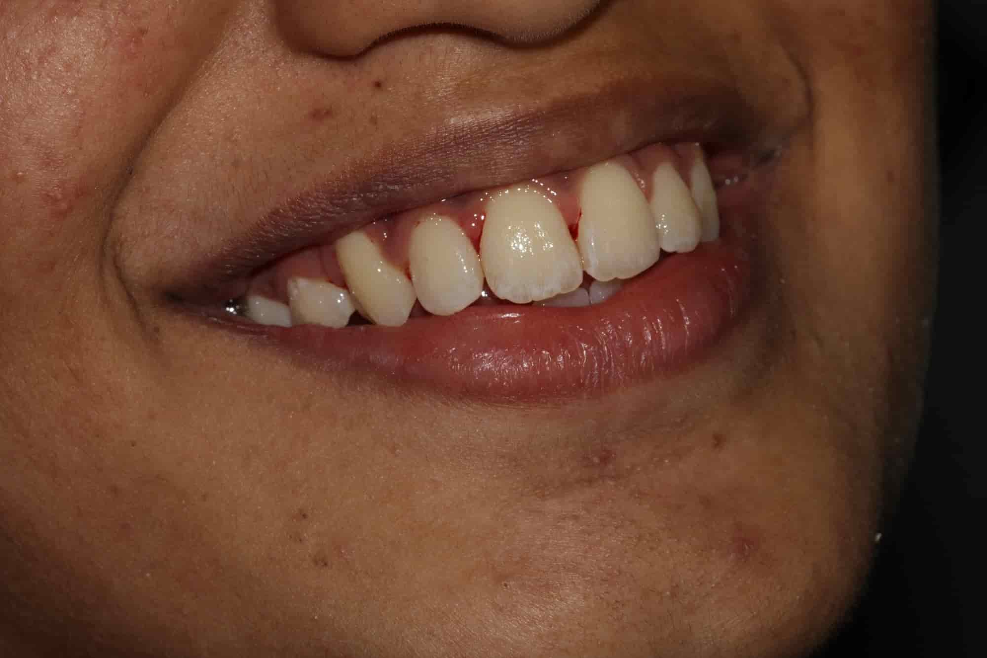 Sree Saraswathi Dental Clinic in Surampatti,Erode Best Dental Clinics