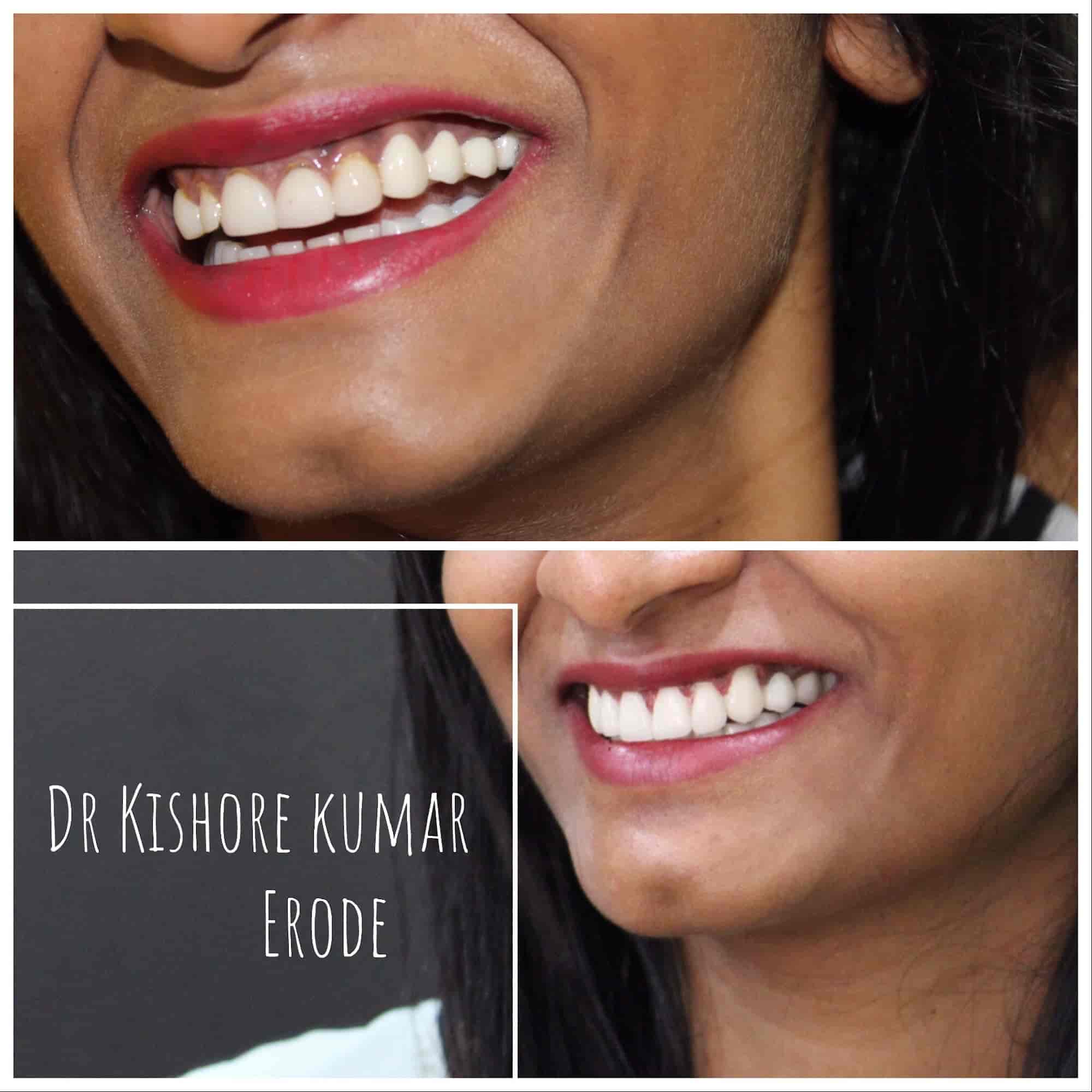 Sree Saraswathi Dental Clinic in Surampatti,Erode Best Dental Clinics