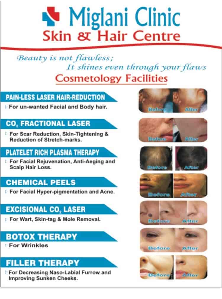 Miglani Skin & Hair Clinic in Faridabad Sector 16,Delhi Best