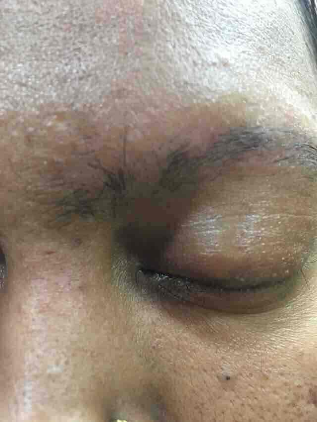 Dr. Ashwin Patel Skin Care Clinic in Kalol,Gandhinagargujarat Best