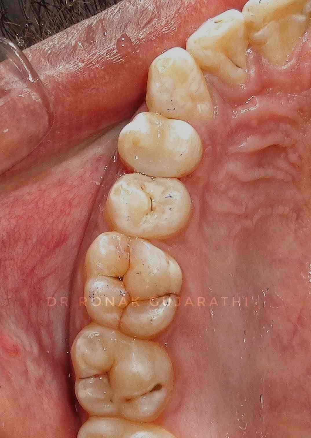 Gujarathi Dental Clinic And Implant Center in Kudasan,Gandhinagar