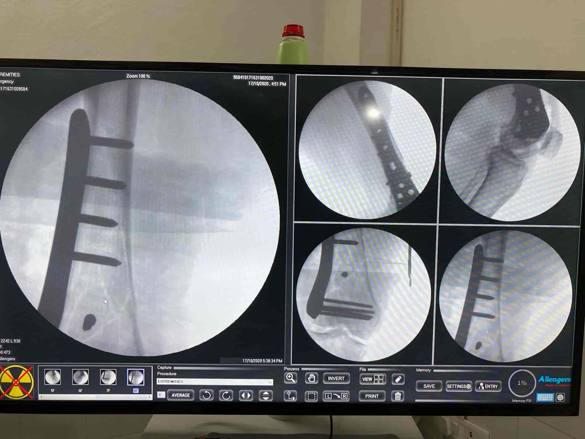 Lab view 13