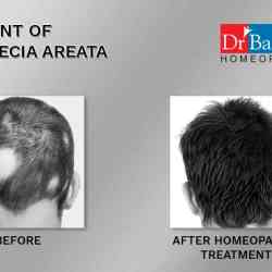 Dr Batras Healthcare in Rdc-raj Nagar Ghaziabad,Delhi - Book Appointment Online - Best Homeopathic Consultants in Delhi - Justdial Dr Batras Healthcare in Rdc-raj Nagar Ghaziabad,Delhi - Book Appointment Online - Best Homeopathic Consultants in Delhi - Justdial