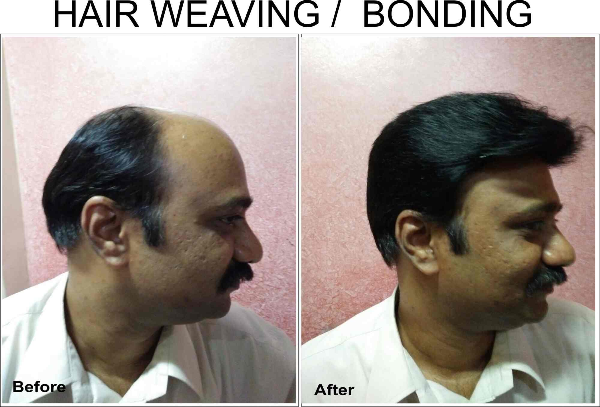 Top 30 Hair Loss Treatment In Goa Best Hair Loss Doctors Book