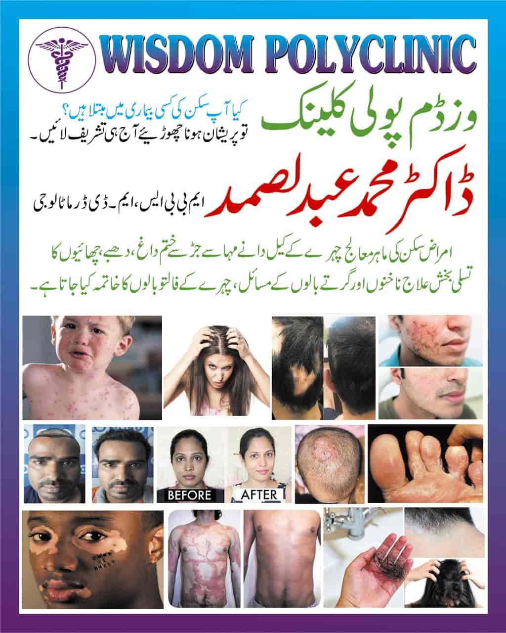 Dr Samad Wisdom Skin Dermatology Clinic in Azadpur RoadGulbarga HO
