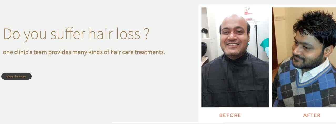 Hair Club in Sushant Lok,Delhi - Best Trichologist Doctors in Delhi - Justdial Hair Club in Sushant Lok,Delhi - Best Trichologist Doctors in Delhi - Justdial