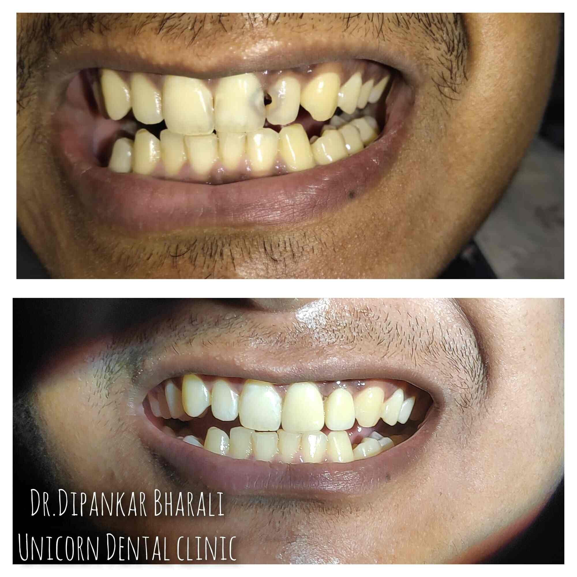 Unicorn Dental Clinic in Hengrabari,Guwahati Best Dental Clinics in