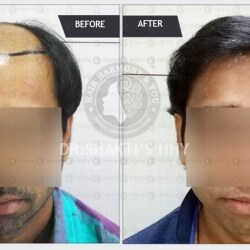 Hair Harmony and You in G S Road,Guwahati - Best Hair Loss Doctors in Guwahati - Justdial Hair Harmony and You in G S Road,Guwahati - Best Hair Loss Doctors in Guwahati - Justdial