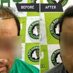 Hair Harmony and You in G S Road,Guwahati - Best Hair Loss Doctors in Guwahati - Justdial Hair Harmony and You in G S Road,Guwahati - Best Hair Loss Doctors in Guwahati - Justdial