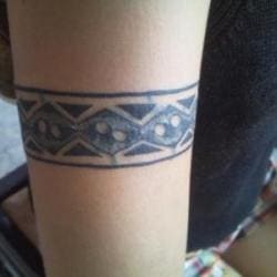 List Of Best Laser Treatment For Tattoo Removal in Guwahati - Best Laser Tattoo Removal Treatment - Justdial List Of Best Laser Treatment For Tattoo Removal in Guwahati - Best Laser Tattoo Removal Treatment - Justdial