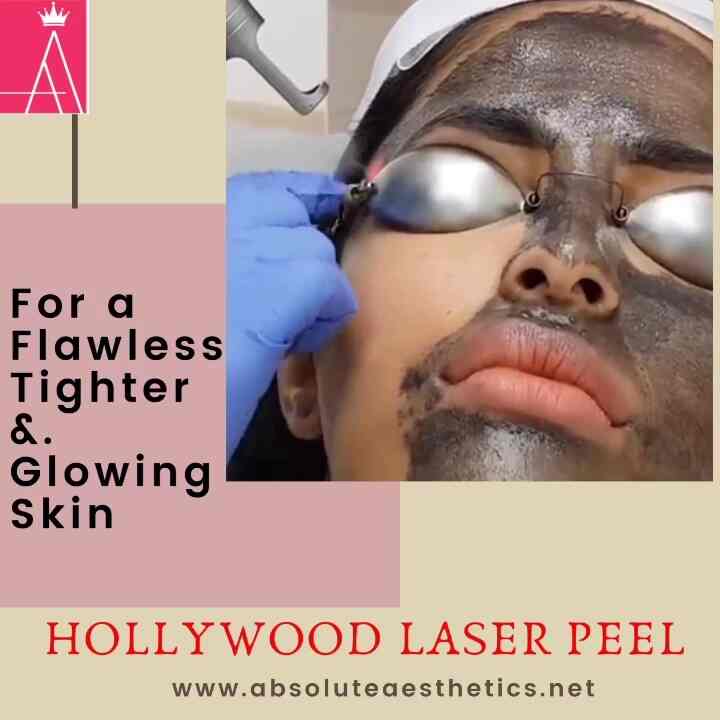 Details more than 147 laser hair removal in guwahati dedaotaonec