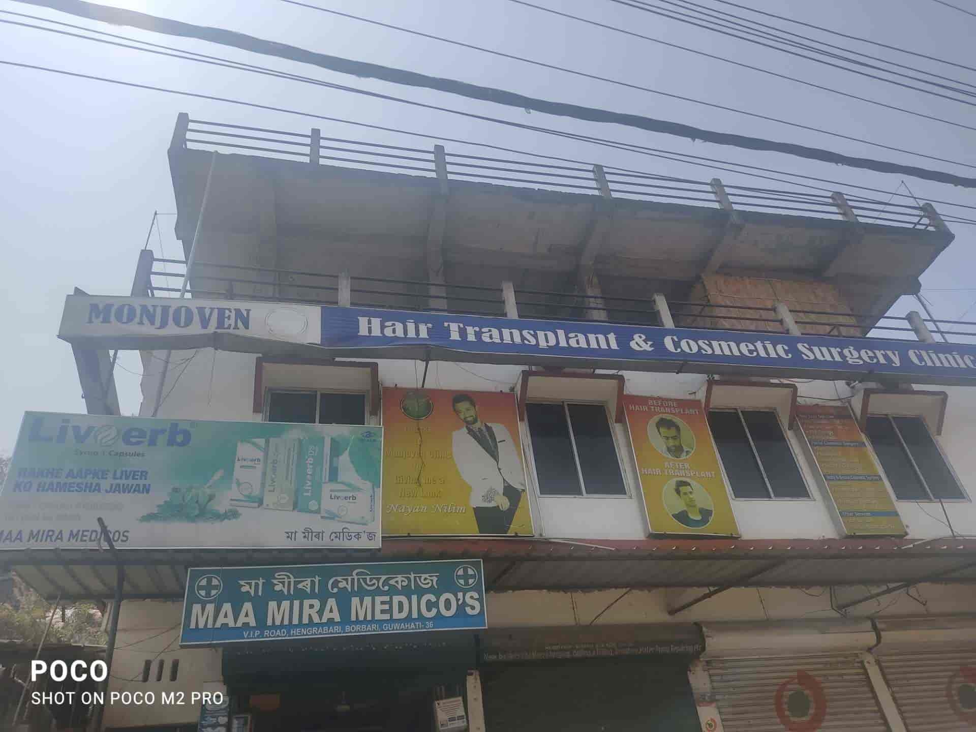 Hair Transplant Surgery clinic in Guwahati at affordable Cost