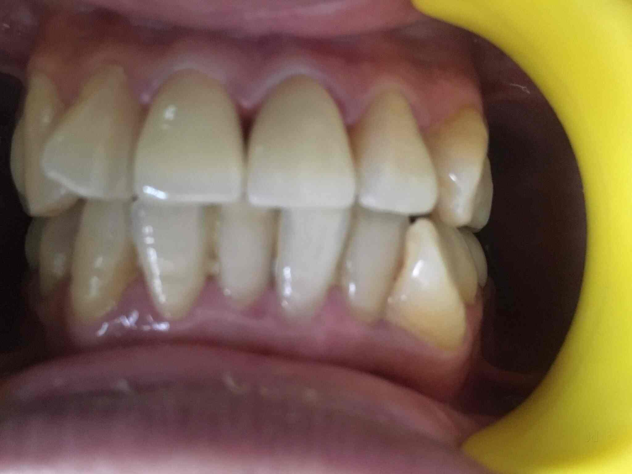 Teeth Care Multi Speciality Orthodontic And Dental Implant Clinic in