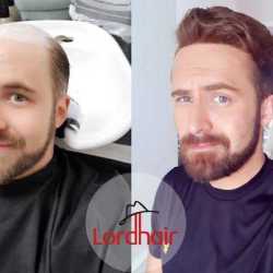 Super Laser Hair And Hair Fixing Centre in Rishi Nagar,Hissar - Best Hair Extension Dealers-Joker wigs arts & crafts in Hissar - Justdial Super Laser Hair And Hair Fixing Centre in Rishi Nagar,Hissar - Best Hair Extension Dealers-Joker wigs arts & crafts in Hissar - Justdial