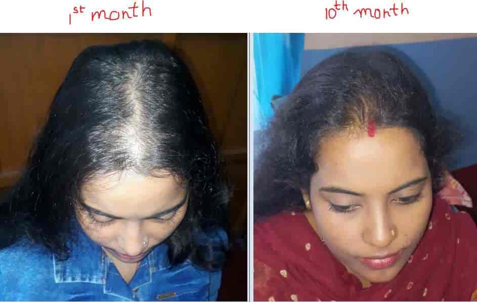 Hair doctor near me discount