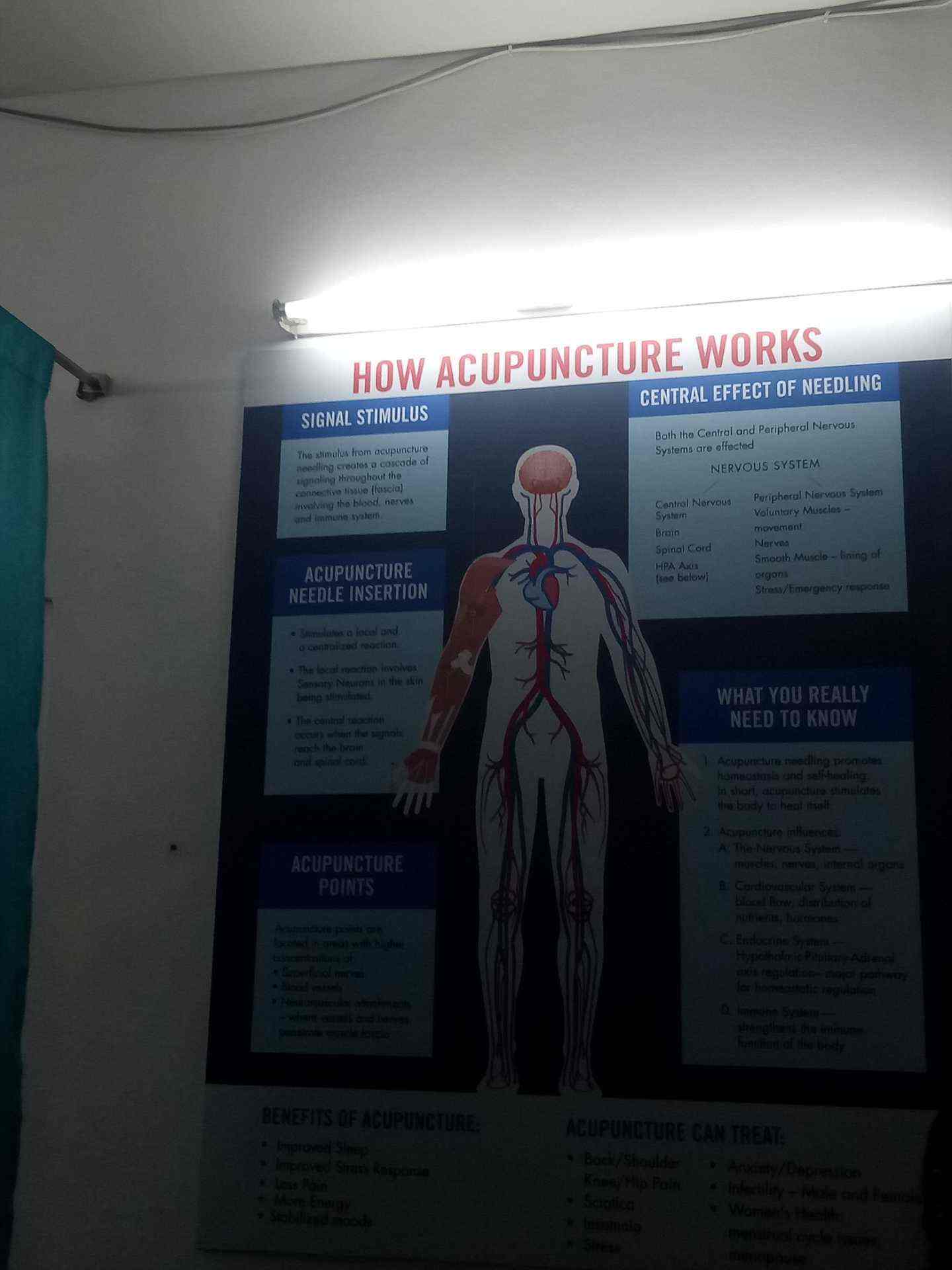 List Of Best Acupuncture Doctors in Ameerpet Best Acupuncture Clinics