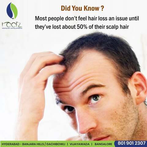 Rootz Hair Clinic in Banjara Hills,Hyderabad - Best Hair Treatment Clinics in Hyderabad - Justdial Rootz Hair Clinic in Banjara Hills,Hyderabad - Best Hair Treatment Clinics in Hyderabad - Justdial