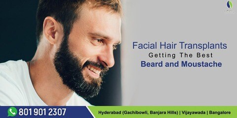 Rootz Hair Clinic in Banjara Hills,Hyderabad - Best Hair Treatment Clinics in Hyderabad - Justdial Rootz Hair Clinic in Banjara Hills,Hyderabad - Best Hair Treatment Clinics in Hyderabad - Justdial