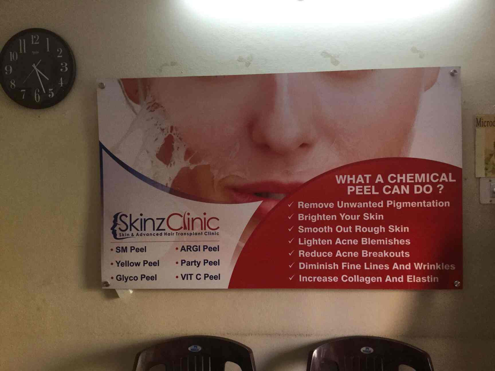 Skinz Clinic in Madhapur,Hyderabad Best Skin Care Clinics in