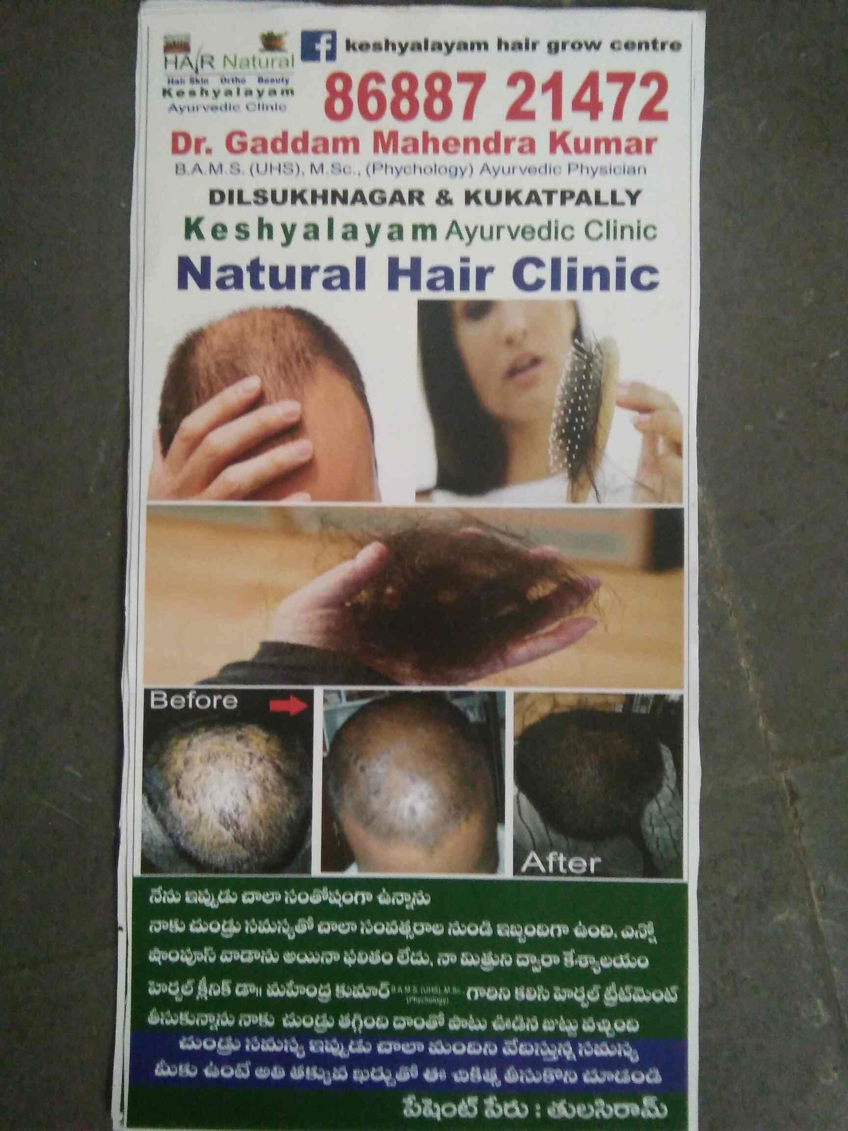 Top Ayurvedic Clinics For Hair Treatment Near Vasan Eye Care