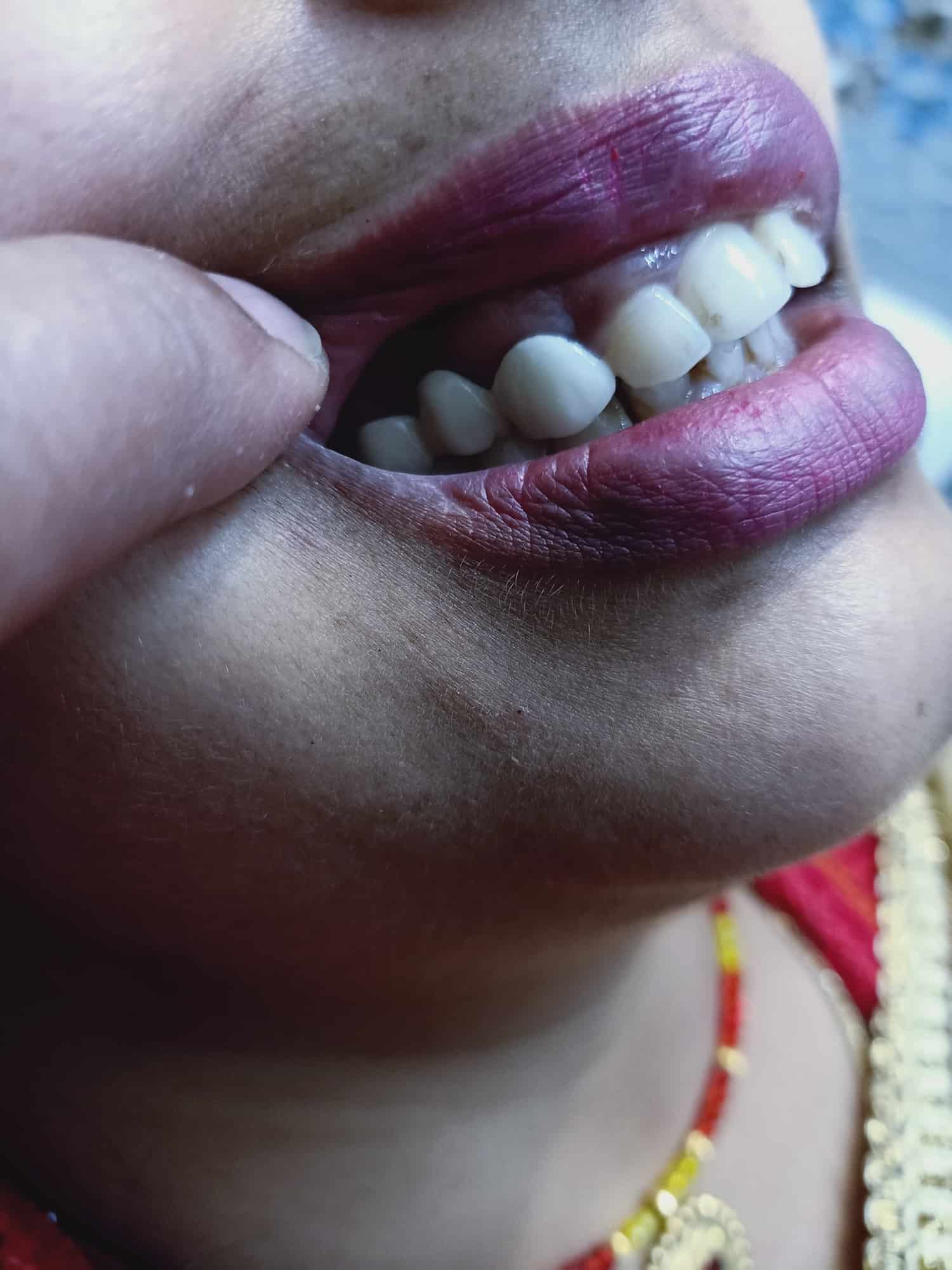 City Dentel Clinic in Kathalbari Road,Islampur-west Bengal - Best Clinics  in Islampur-west Bengal - Justdial