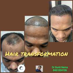 Dr. Nema Hair & Cosmetic Surgery Clinic in Behind Sunil Hosiery Shop, Opposite Bhawartal Garden - Book Appointment Online - Best Dermatologists in Jabalpur - Justdial Dr. Nema Hair & Cosmetic Surgery Clinic in Behind Sunil Hosiery Shop, Opposite Bhawartal Garden - Book Appointment Online - Best Dermatologists in Jabalpur - Justdial