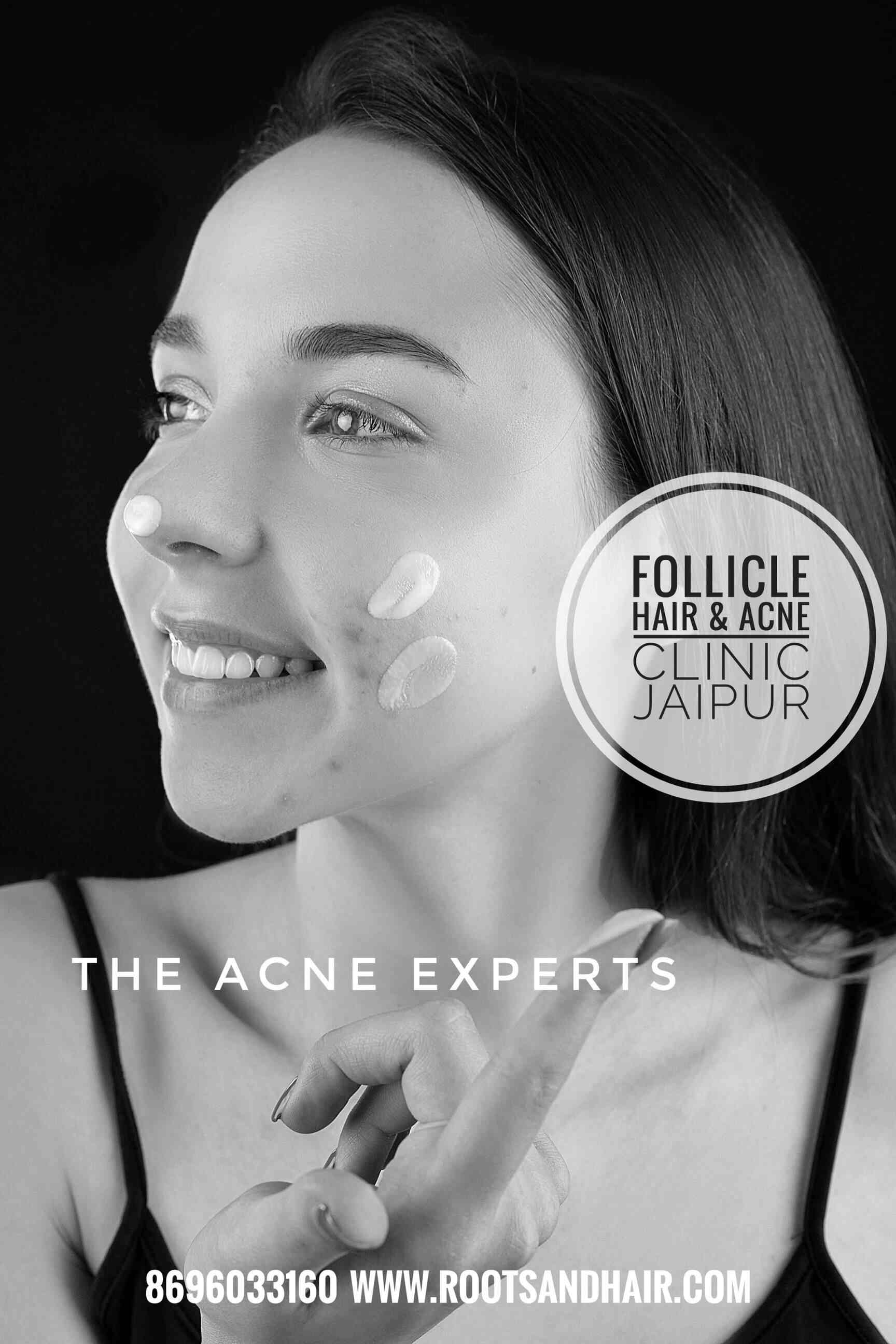 Follicle Hair Clinic & Hair Transplant Center in C Scheme,Jaipur Best