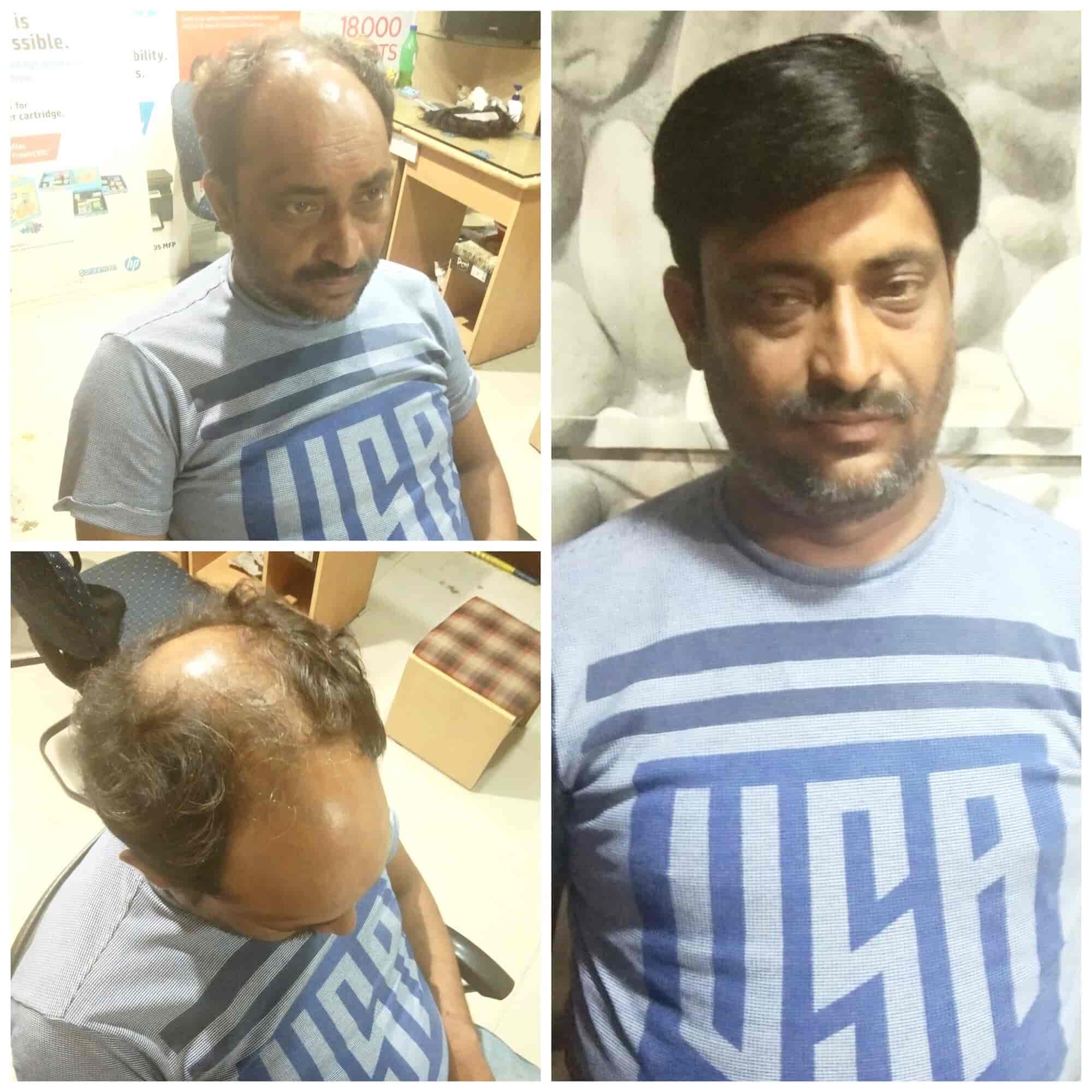 Share 134+ hair wig in jaipur super hot ceg.edu.vn